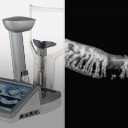 Meibomian gland imaging